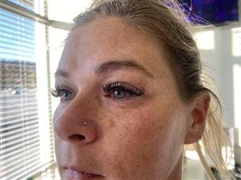 Eyelash extension results